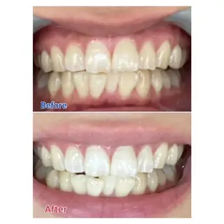 M渋谷店所属・M渋谷 ホワイトニングのエステ・リラクイメージ