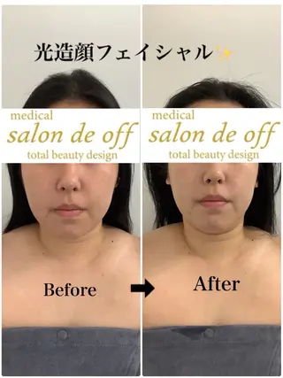 🩵Tatsumi Kana🩵のエステ・リラクイメージ