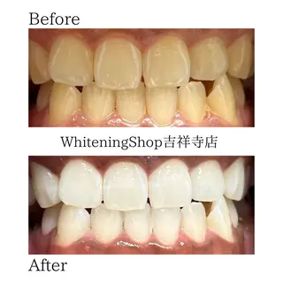 ホワイトニング ショップ吉祥寺店のエステ・リラクイメージ