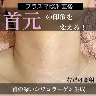 トータルエステサロン Tiaraのエステ・リラクイメージ