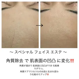 ビューティー ミロワールのエステ・リラクイメージ