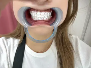 ecxia white 高田馬場所属・セルフホワイトニング エクシア 高田馬場のその他イメージ