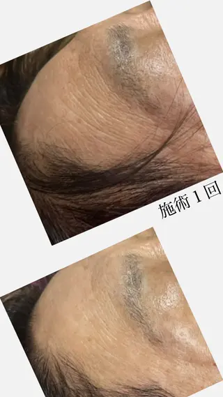 脱毛和みサロン新茶屋所属・脱毛和みサロン新茶屋 ひろみ（女性専用）のエステ・リラクイメージ