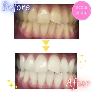 エクシアホワイト旭橋店所属・セルフホワイトニング エクシア旭橋店のその他イメージ