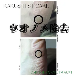 carenail　 tsugumiのその他イメージ