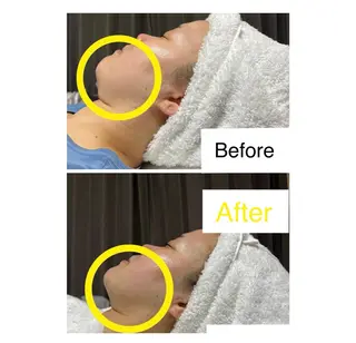 ROR Akariのエステ・リラクイメージ