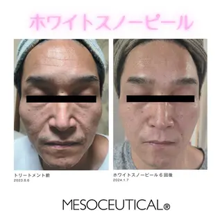 アドミーロ 💎CHIKA💎のエステ・リラクイメージ