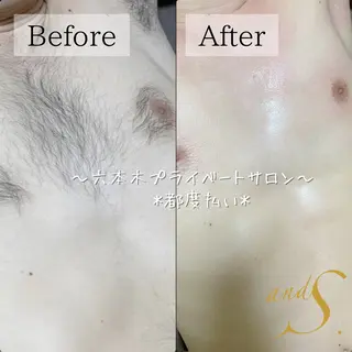 メンズ 🌸🧡六本木 脱毛しずか🧡🫧の眉毛・アイブロウイメージ