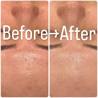 立体小顔×艶肌×美ボ ディ似合わせ施術 岡のエステ・リラクイメージ