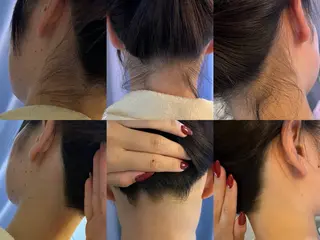 うなじ脱毛/美肌脱毛 LABELのエステ・リラクイメージ