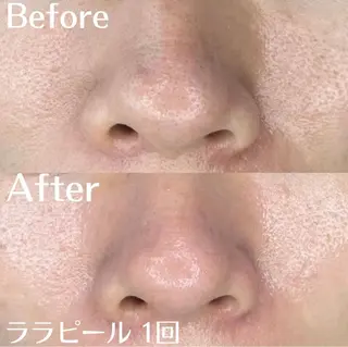 中目黒ハーブピーリン グ🌿ララピールのエステ・リラクイメージ