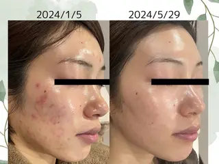 ベルーテ エッセンスのエステ・リラクイメージ