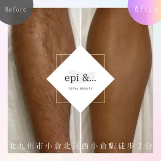 epi &... TOTAL BEAUTY所属・epi &... Harukaのエステ・リラクイメージ