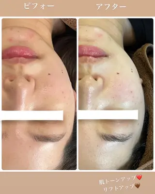 FLEURフェイシャ ル🫧ハーブ🌿小顔のエステ・リラクイメージ