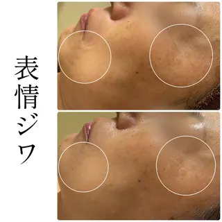 ハーブピーリング専門 BIOEL横浜のエステ・リラクイメージ