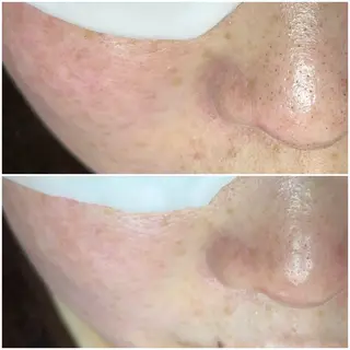 毛穴汚れ改善専門店/ 岸和田/リヒオルオルのエステ・リラクイメージ