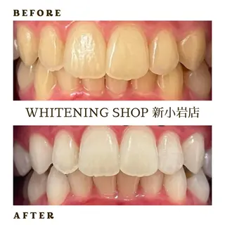 メンズ ホワイトニング ショップ新小岩店のその他イメージ