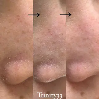 Liber Kyoto所属・魔法の シミ取り職人のエステ・リラクイメージ