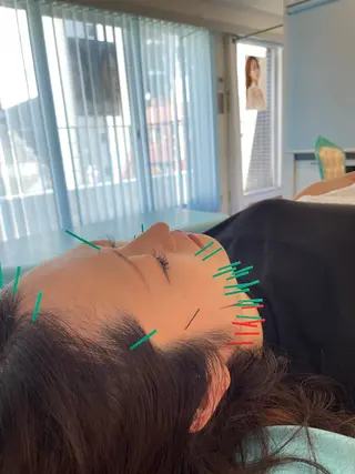 小顔美容鍼専門サロン 渋谷YZのエステ・リラクイメージ