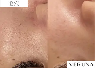 業界初の頭皮ケア 棘スカルプLUNEAのヘアスタイル