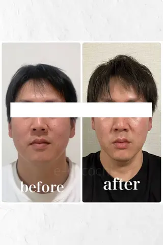 小顔と ヘッドスパのお店のエステ・リラクイメージ