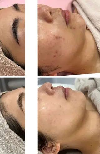 NOAH 小顔毛穴 川越店所属・NOAH ORIEのエステ・リラクイメージ