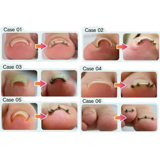 ネイル Magenta所属・Magenta 谷口のネイルデザイン