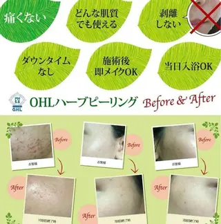 エステサロン ユミのエステ・リラクイメージ