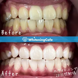 ホワイトニングカフェ徳島沖浜店所属・ホワイトニングカフェ 徳島沖浜店のエステ・リラクイメージ