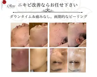 堀井 舞琳のエステ・リラクイメージ