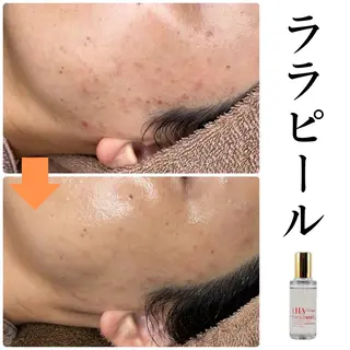 Babel 〜都度払いサロン〜のエステ・リラクイメージ