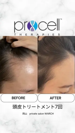 WARCH Marieのその他イメージ