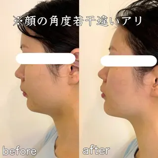 小顔矯正&美容整体 整え屋REDオーナーのエステ・リラクイメージ