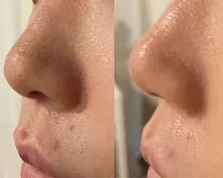 よもぎ蒸し専門店Artemisia所属・よもぎ蒸し専門店 Artemisiaのエステ・リラクイメージ