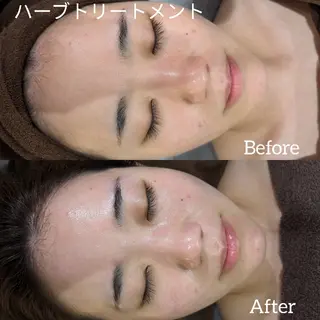 ﾌｪｲｼｬﾙｴｽﾃ ﾗﾄｩｰﾙ伊深のエステ・リラクイメージ