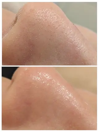 babyaiai所属・babyaiai 　momo🍑のエステ・リラクイメージ