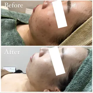 ハーブピーリング専門 muro.のエステ・リラクイメージ