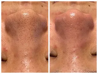 メンズ 美Face所属・美 Faceのエステ・リラクイメージ