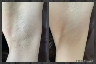 杉原 里奈のエステ・リラクイメージ