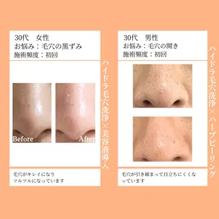 小顔・ツルツル素肌 ハリステリアのエステ・リラクイメージ