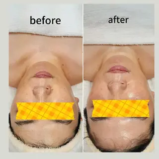 メナードフェイシャルサロンライズミュー所属・鈴木 由美のエステ・リラクイメージ