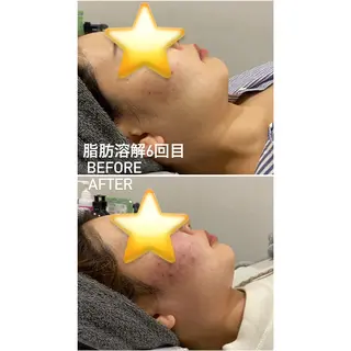 毛穴洗浄・痩身・脱毛 /アルカンジュのエステ・リラクイメージ