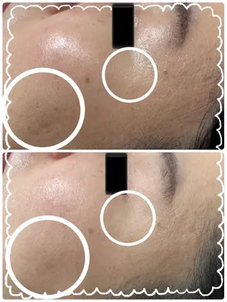 esthesalon Ran所属・小顔美肌痩身サロン Ranのその他イメージ