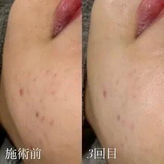 艶肌デトックス🫧 Samiraのエステ・リラクイメージ