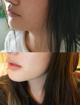 aliaハイフ&水光ジェットサロン所属・aliaハーブ水光店 エステティシャン募集のエステ・リラクイメージ