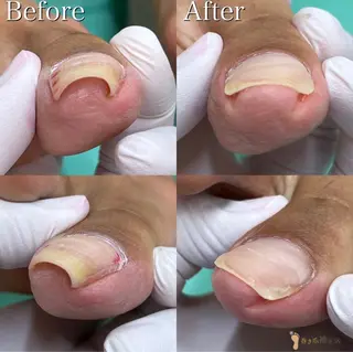 巻き爪補正店 松戸店のネイルデザイン