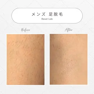 ResetLab 佐藤 風香のエステ・リラクイメージ