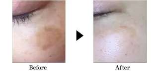 マツエク・マツパ ヘアアレンジ ロング キッズ メンズ ネイル 次世代まつげパーマは 『リベル名古屋』のマツエク・マツパデザイン