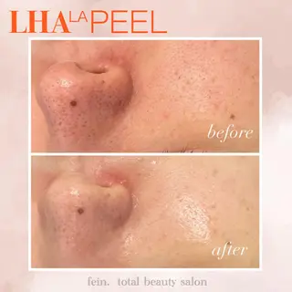 🌈fein.トータ ルビューティー🌈のマツエク・マツパデザイン