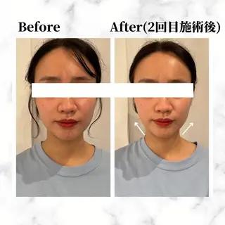 12Dハイフ💗 最強小顔のエステ・リラクイメージ